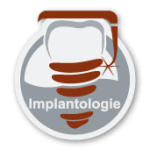 Praxisklinik Bartsch - Implantologie in Karlsruhe
